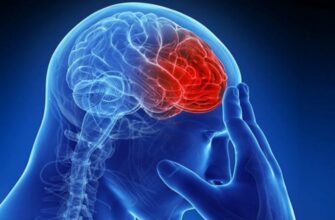 Что такое инсульт: причины, симптомы и способы профилактики