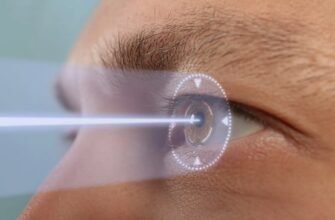 Лазерная коррекция зрения: что это и как проходит процедура?