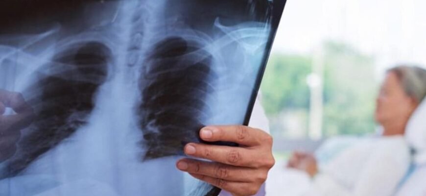 Что такое легочная гипертензия: причины, симптомы и лечение