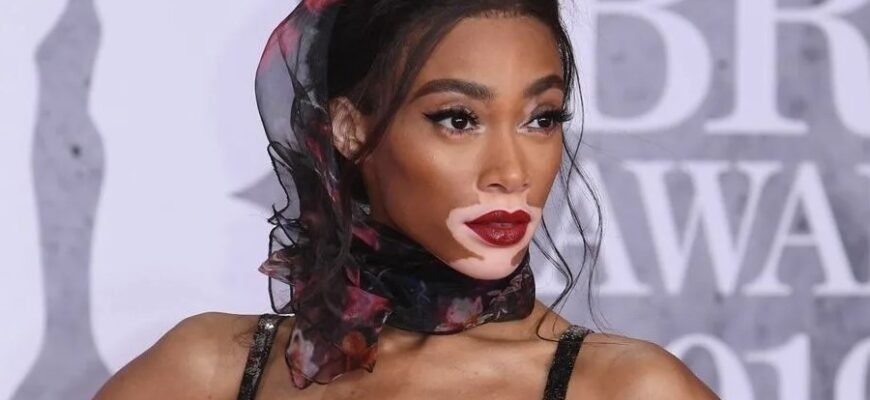 Витилиго: причины, симптомы и методы лечения кожного заболевания