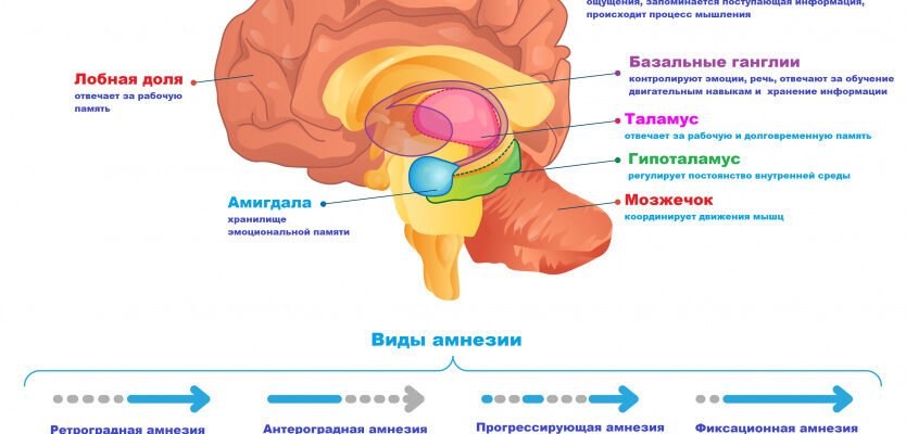 Что такое амнезия: виды, причины и методы лечения нарушения памяти Что такое амнезия: виды, причины и методы лечения нарушения памяти