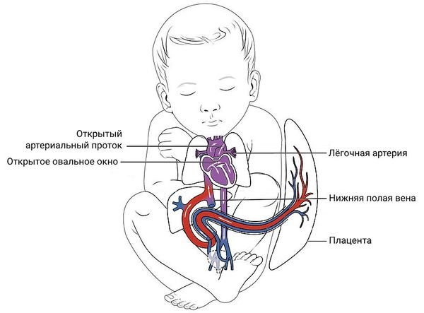 Ишемическая болезнь сердца: причины, симптомы, факторы риска ...