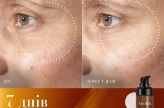 Купити ефективний крем від пігментних плям: поради та рекомендації