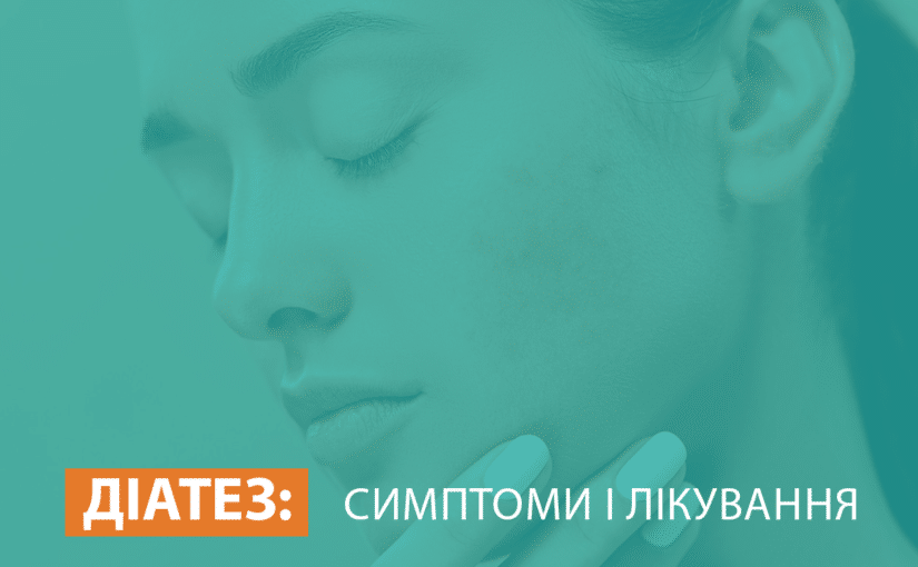 Лекція 4 Звіти про дефекти