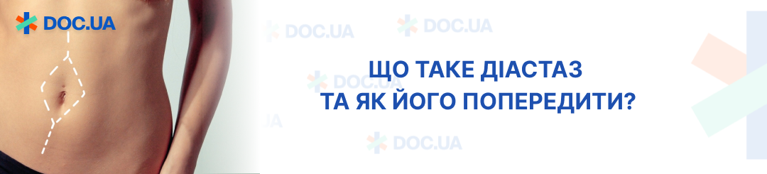 Що таке діастаз та як його попередити? | doc.ua