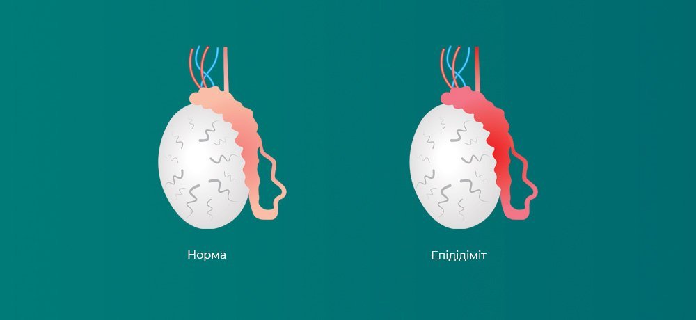 ♻️Що варто знати про цистит♻️ За репост +100 в карму доказово ...