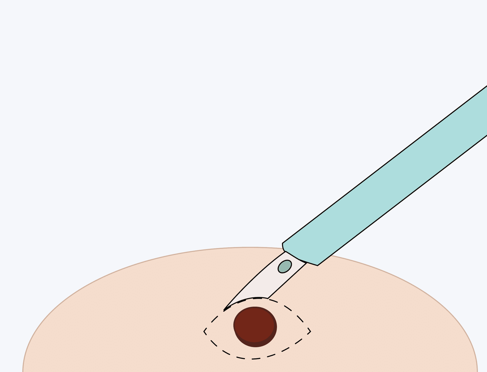 Як стрес впливає на шкіру і що таке психодерматологія - GMKA ...