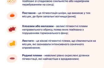 Як боротися з пігментними плямами від сонця: поради та засоби